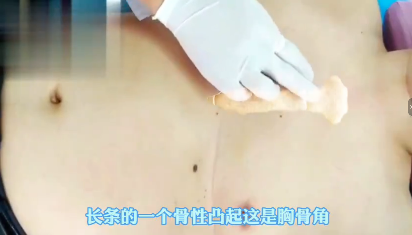 第567肋剑突视频封面