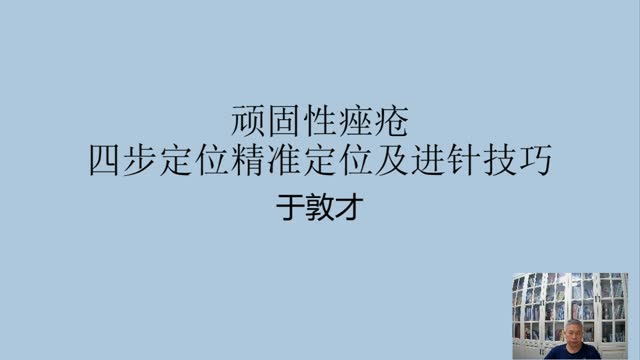年临床经验分享——面部顽固痤疮四步定位精准定点及进·008视频封面