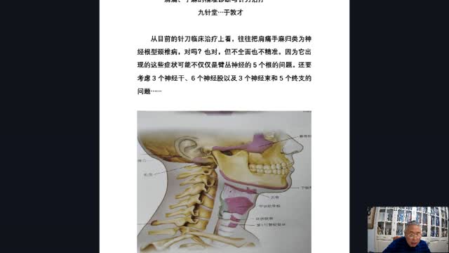 顽固性颈肩综合症——于敦才教授(1)·057视频封面