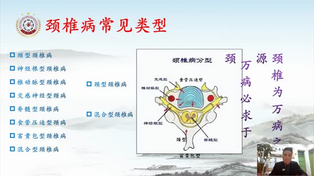 第七讲:颈型及神经根型颈椎病的诊疗和定点视频封面