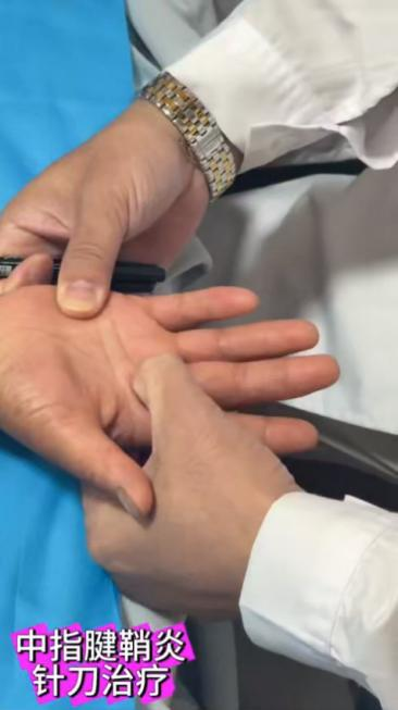 中指屈指肌腱腱鞘炎针刀治疗视频视频封面