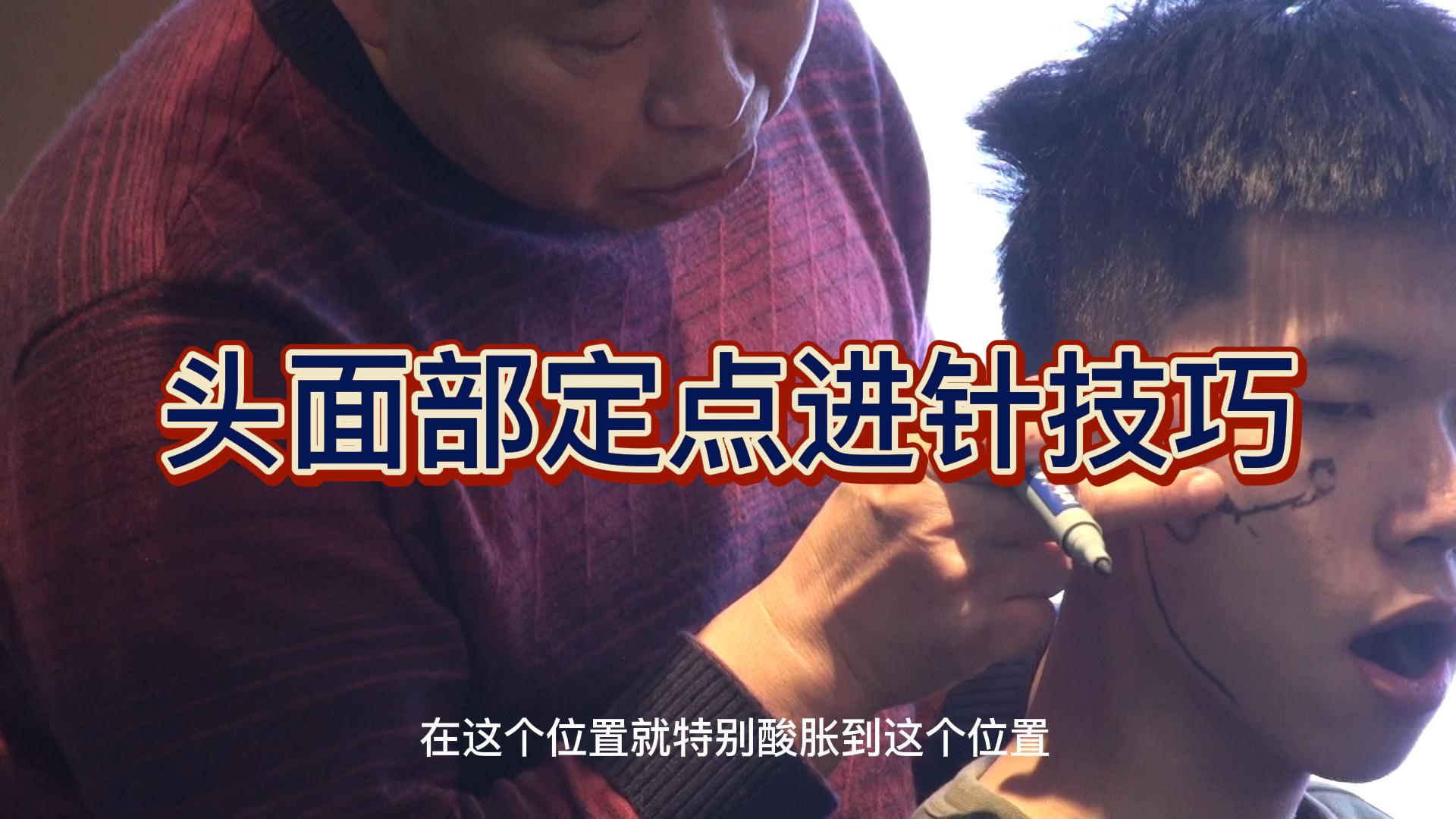 头面部定点进针技巧视频封面