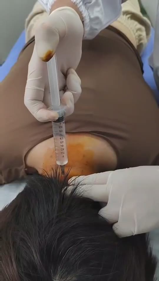 治愈眩晕视频封面