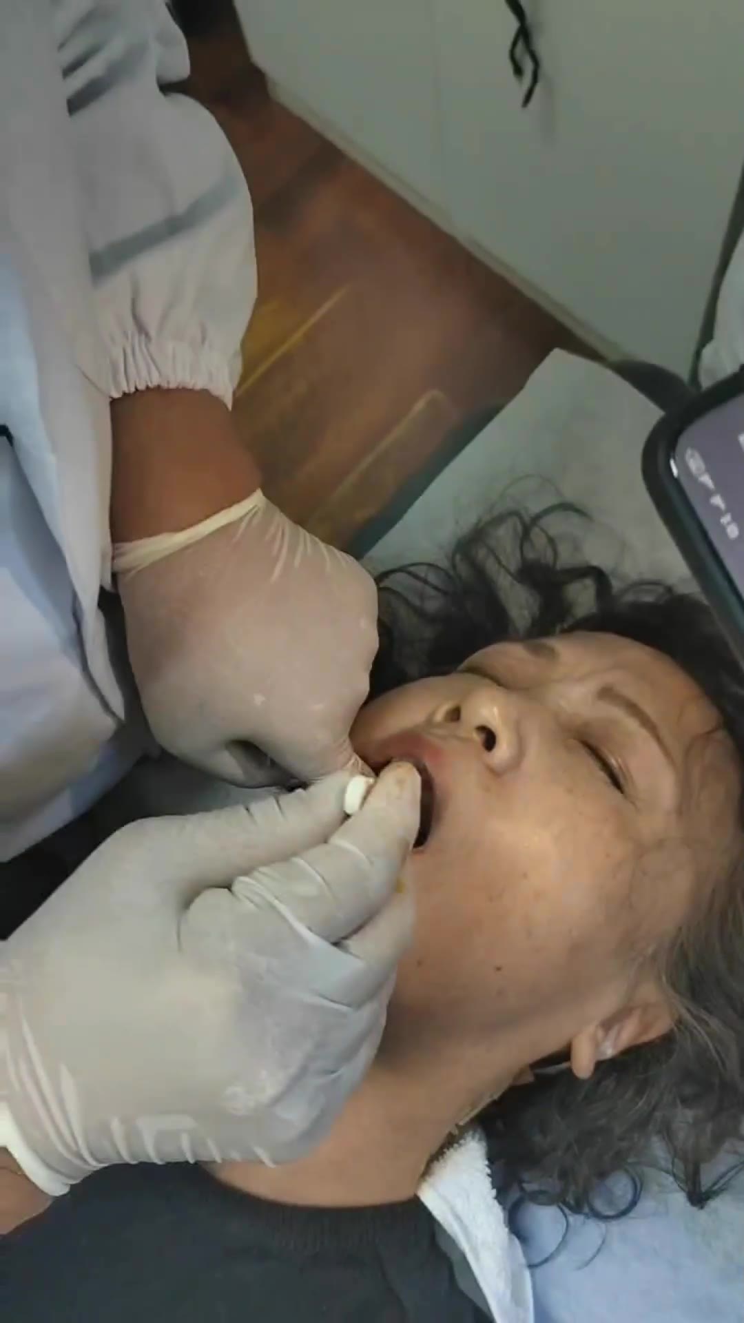 治疗三叉神经痛2诊视频封面