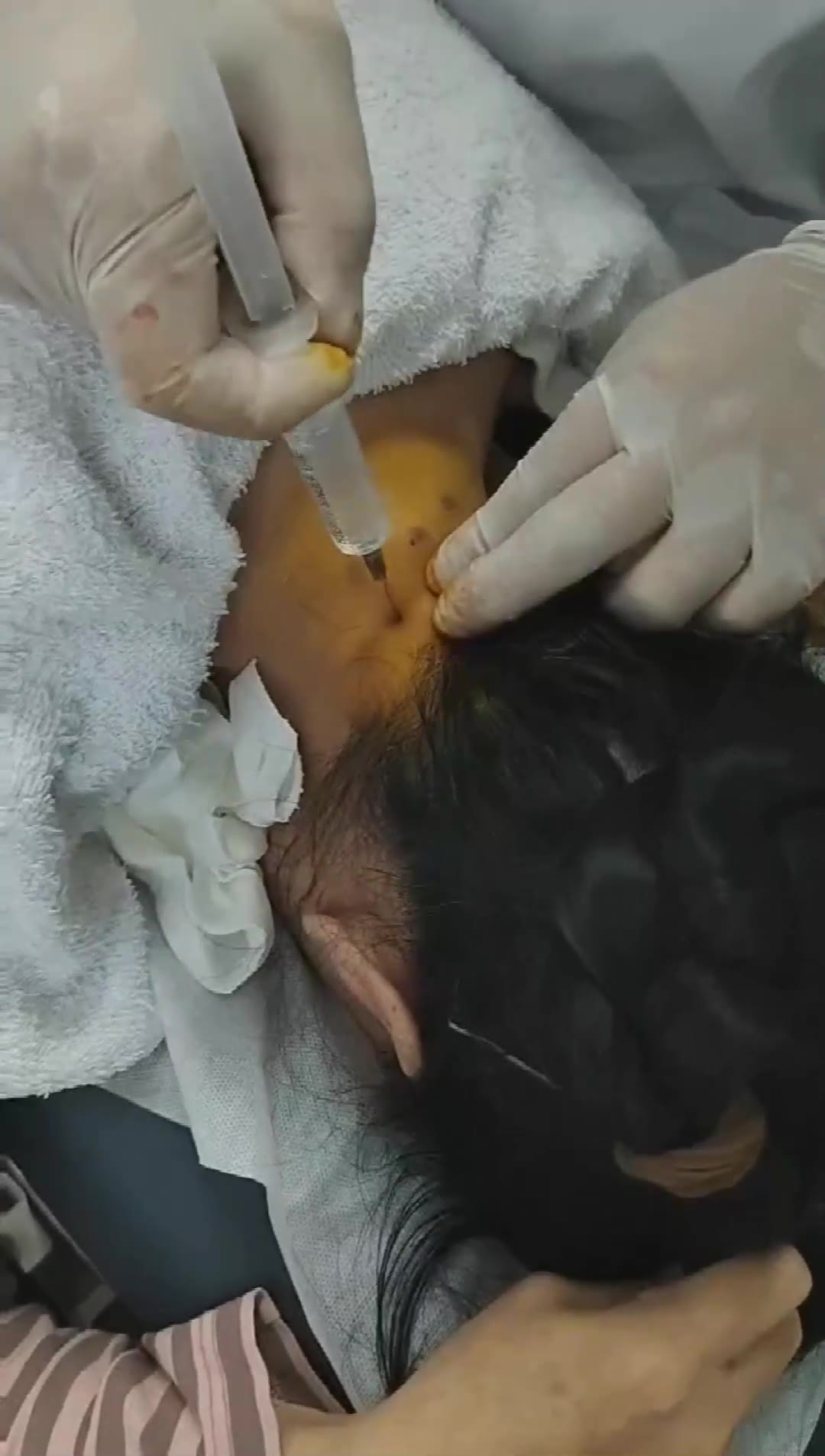 治疗头昏失眠视频封面