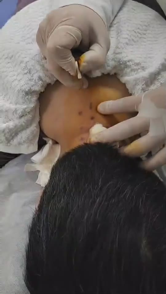 治疗头昏失眠焦虑视频封面