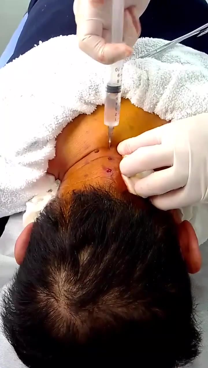 治疗头晕乏力视频封面