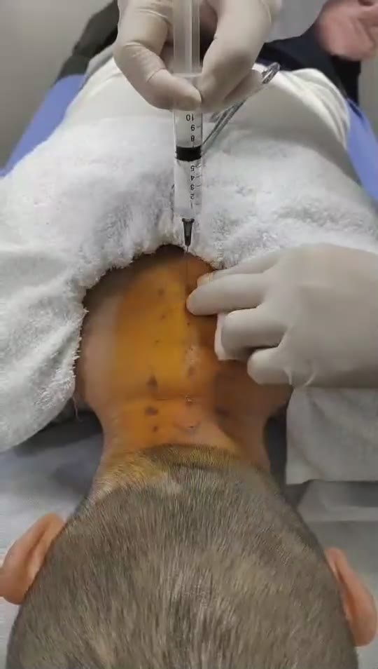 治疗心律不齐视频封面