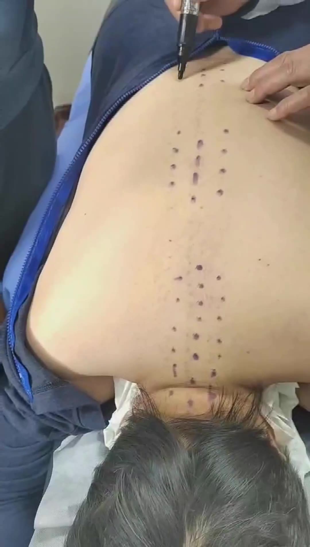 治疗慢性乙肝（16诊）视频封面