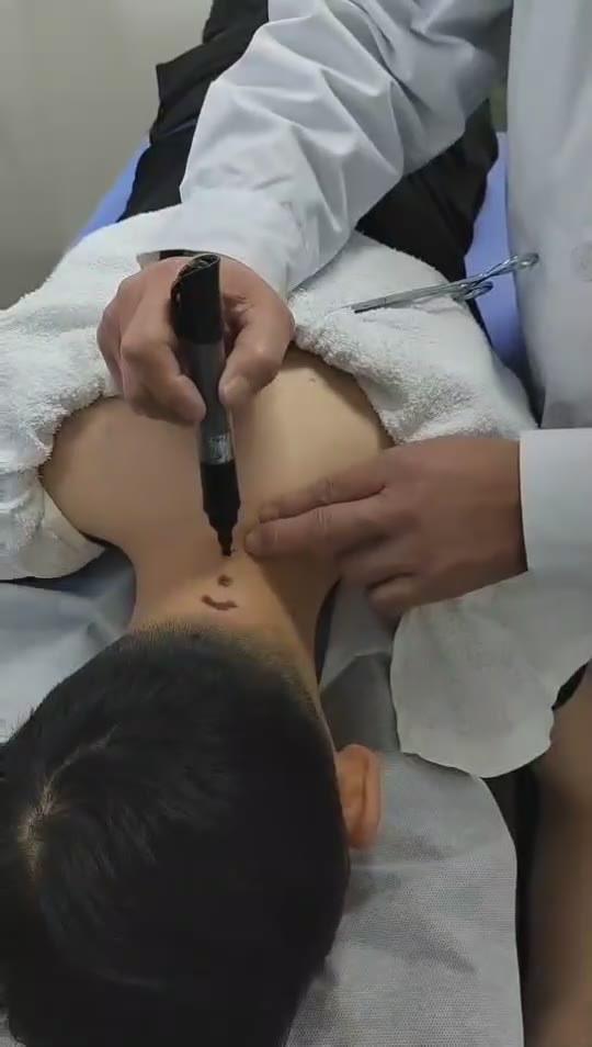 治疗成人斯蒂尔病视频封面