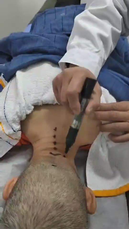 治疗旋晕视频封面