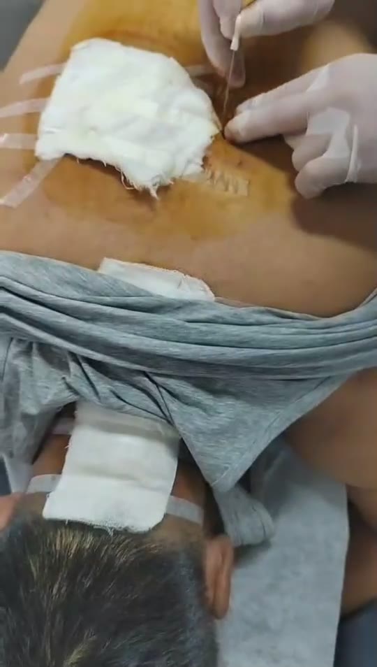 治疗气短心悸视频封面