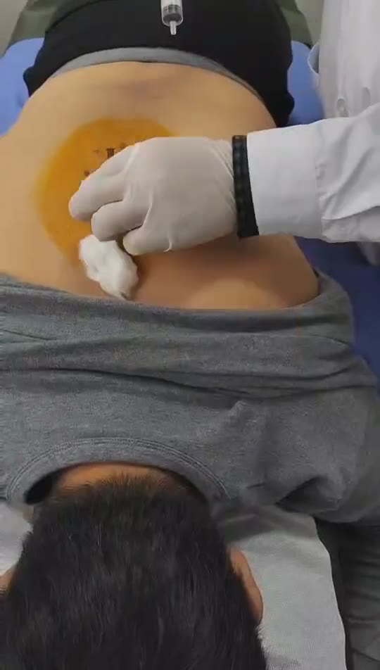 治疗糖尿病（1诊视频封面
