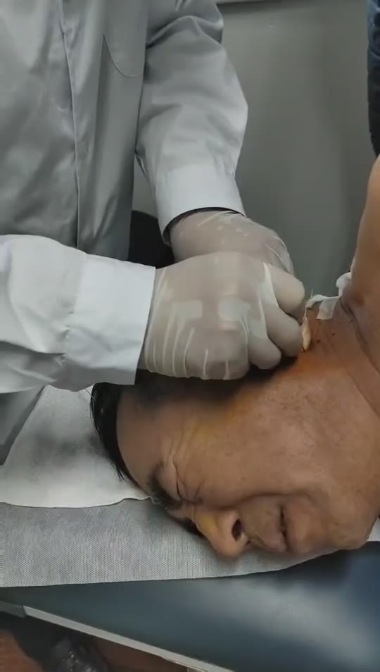 治疗耳鸣视频封面