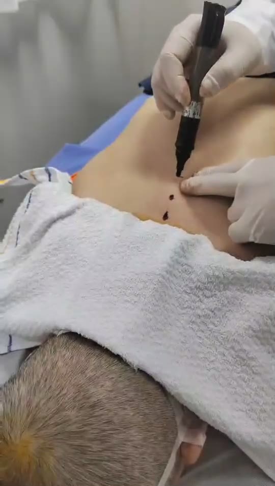 治疗胸闷气短视频封面