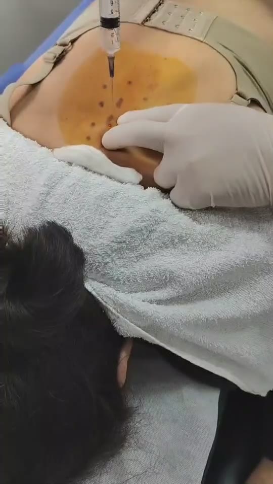 治疗胸闷气短心慌视频封面
