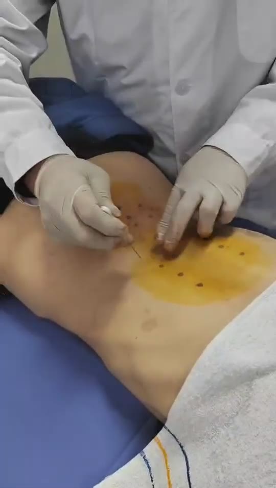 治疗腰肌劳损视频封面