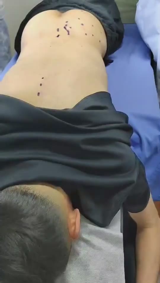 治疗腰臀疼痛视频封面