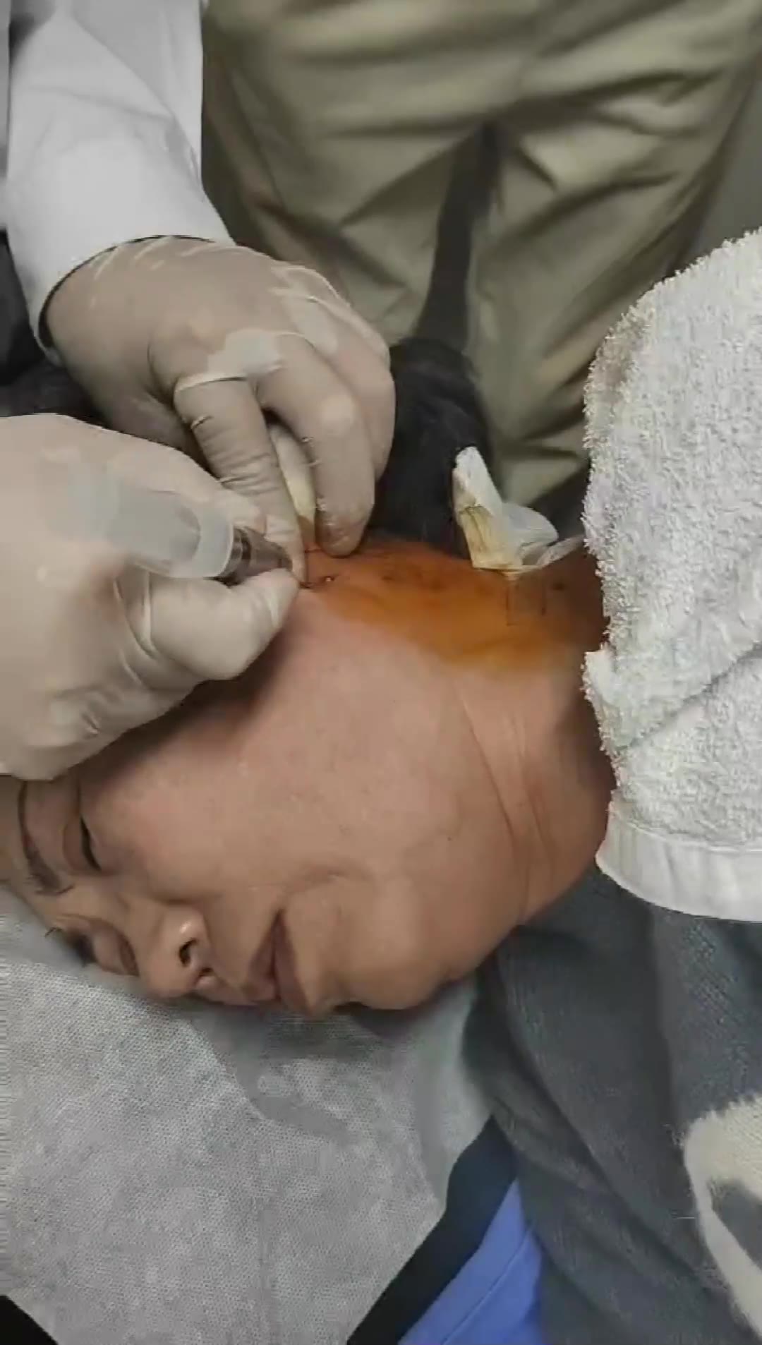 治疗见凉风头痛视频封面