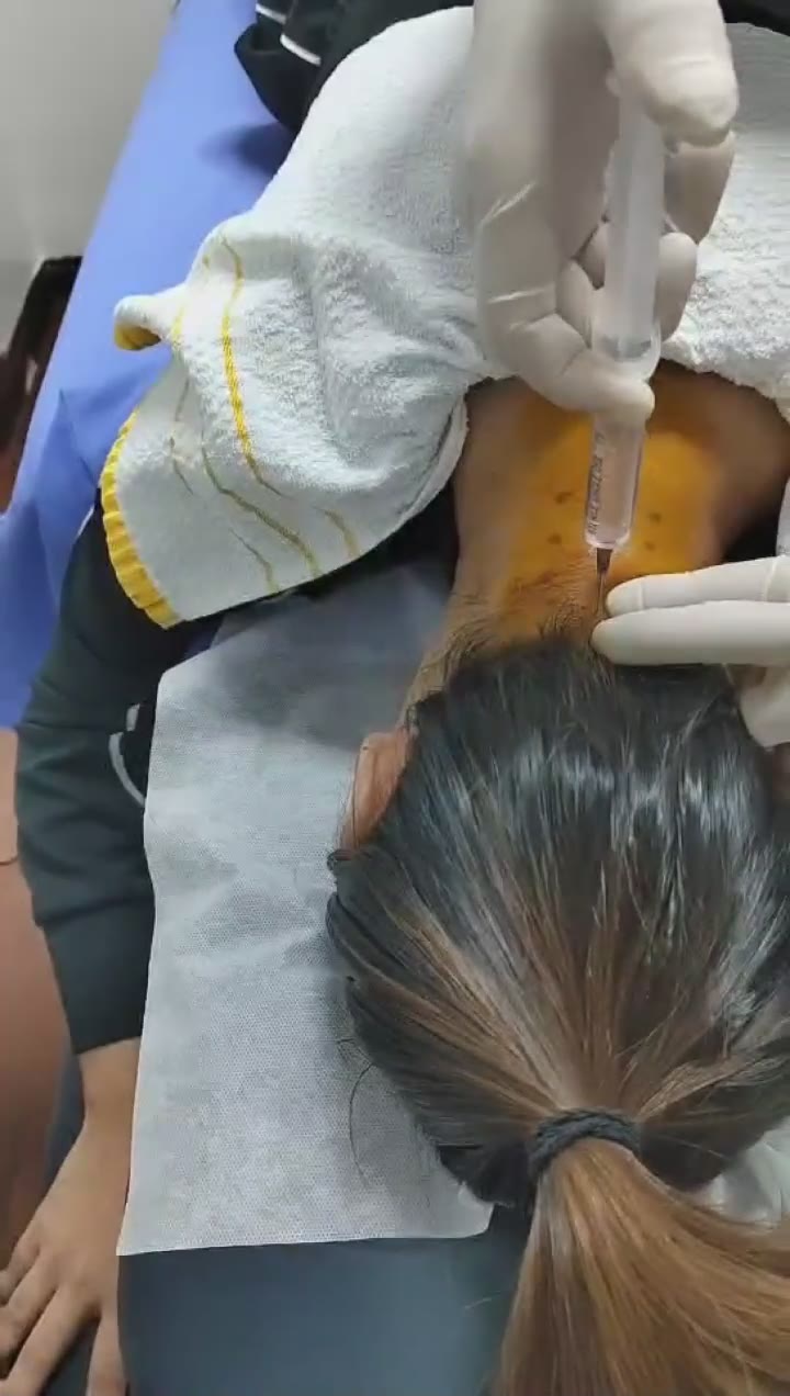 治疗面瘫后遗症视频封面