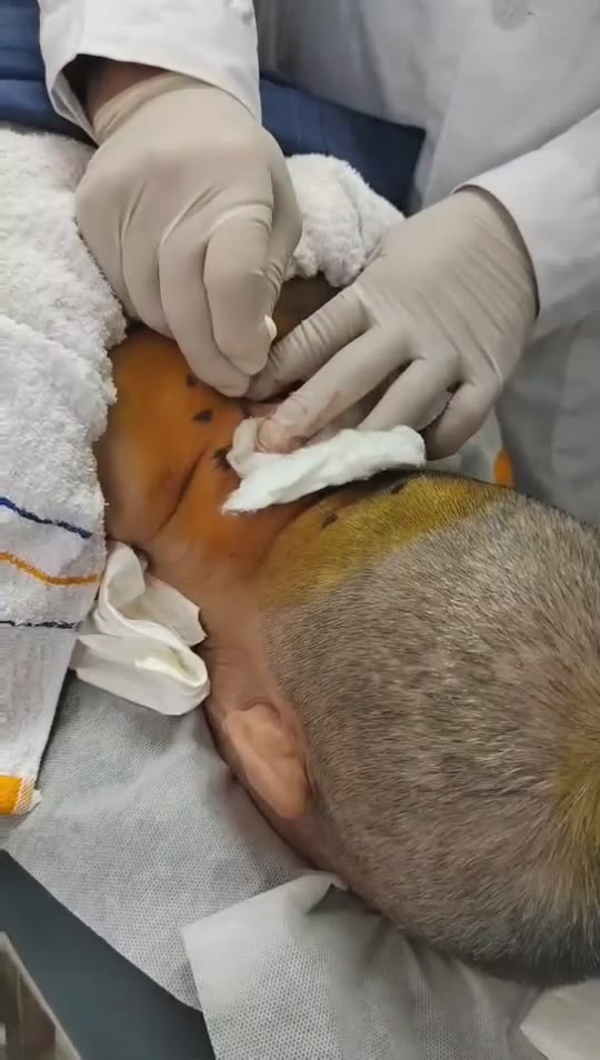 治疗顽固性失眠1诊视频封面