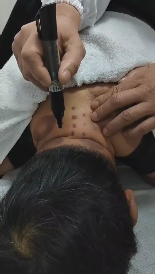 治疗顽固性肩膀痛视频封面
