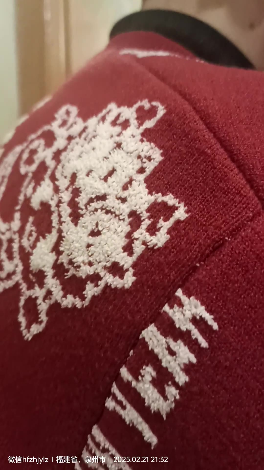 骶骨铲剥术后反应与强度把控视频封面