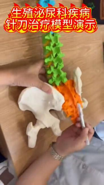 生殖泌尿系统疾病模型讲解视频封面