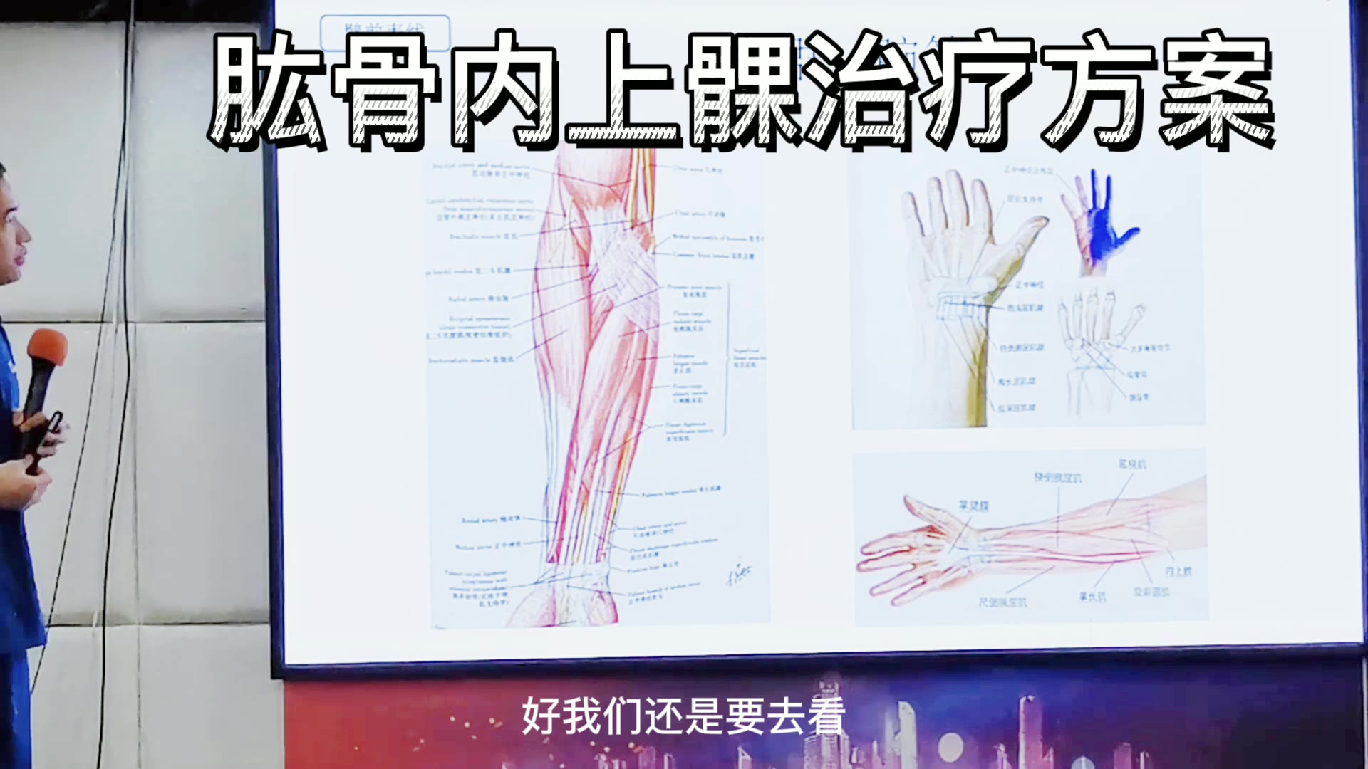网球肘深度讲解视频封面