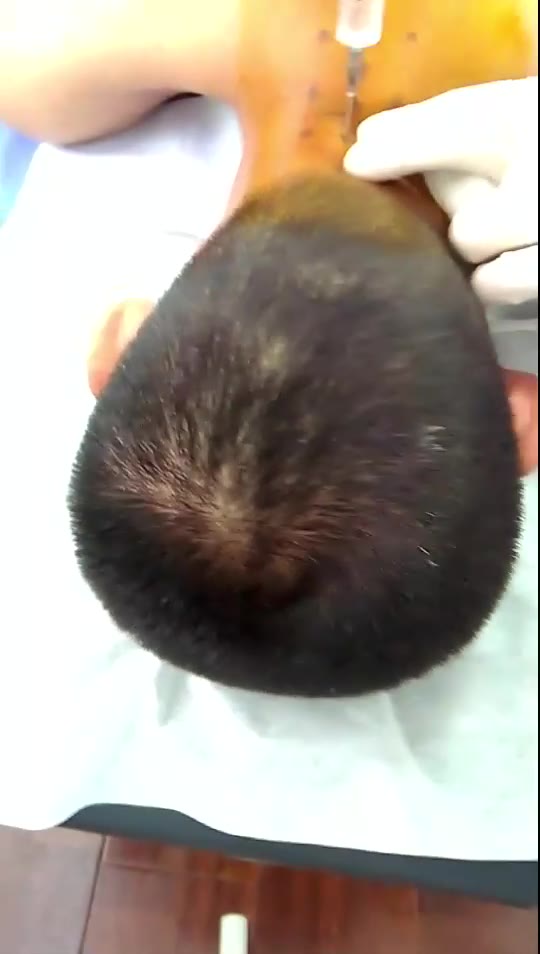 肩痛，手麻2视频封面