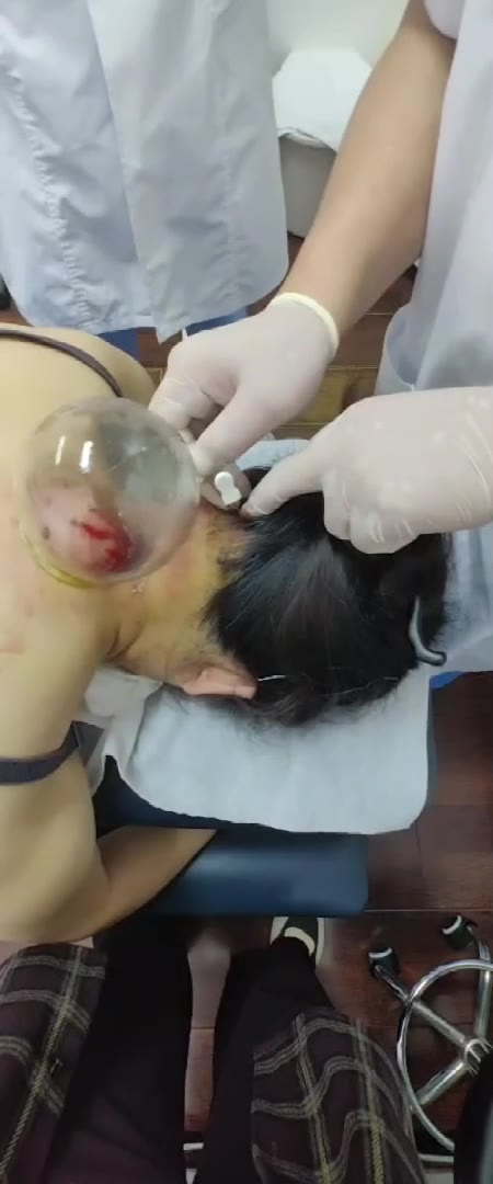 胃溃疡视频封面
