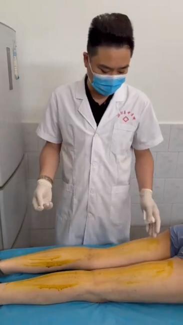 胫神经卡压针刀治疗视频视频封面
