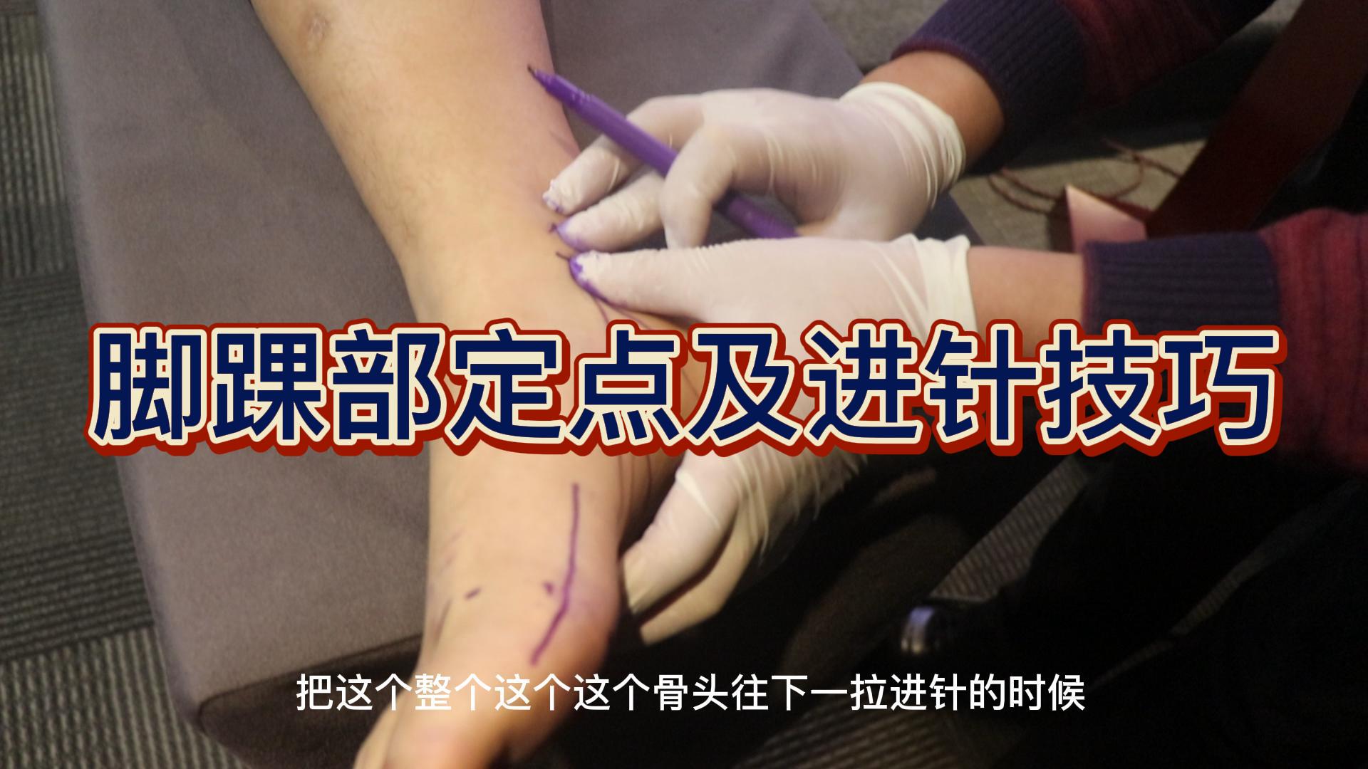 脚踝部定点及进针技巧视频封面