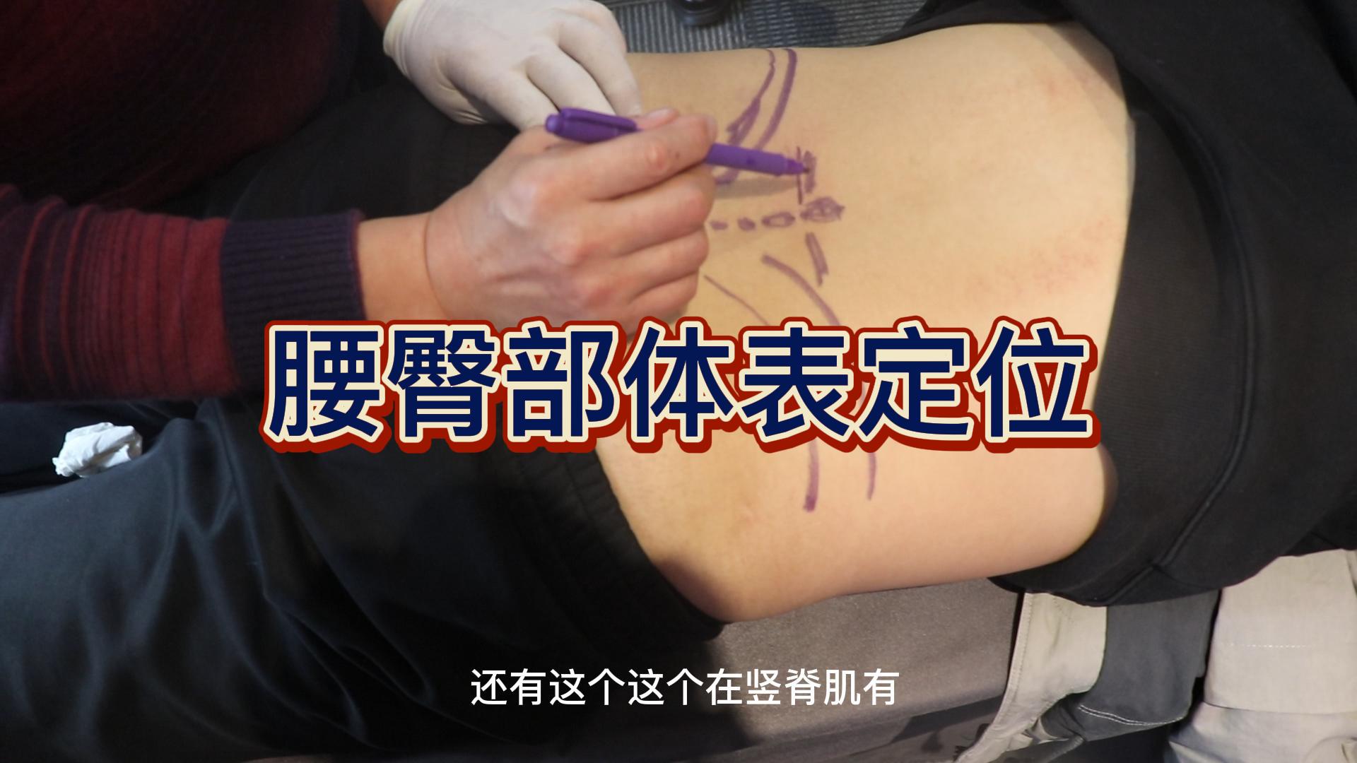 腰臀部体表定位视频封面