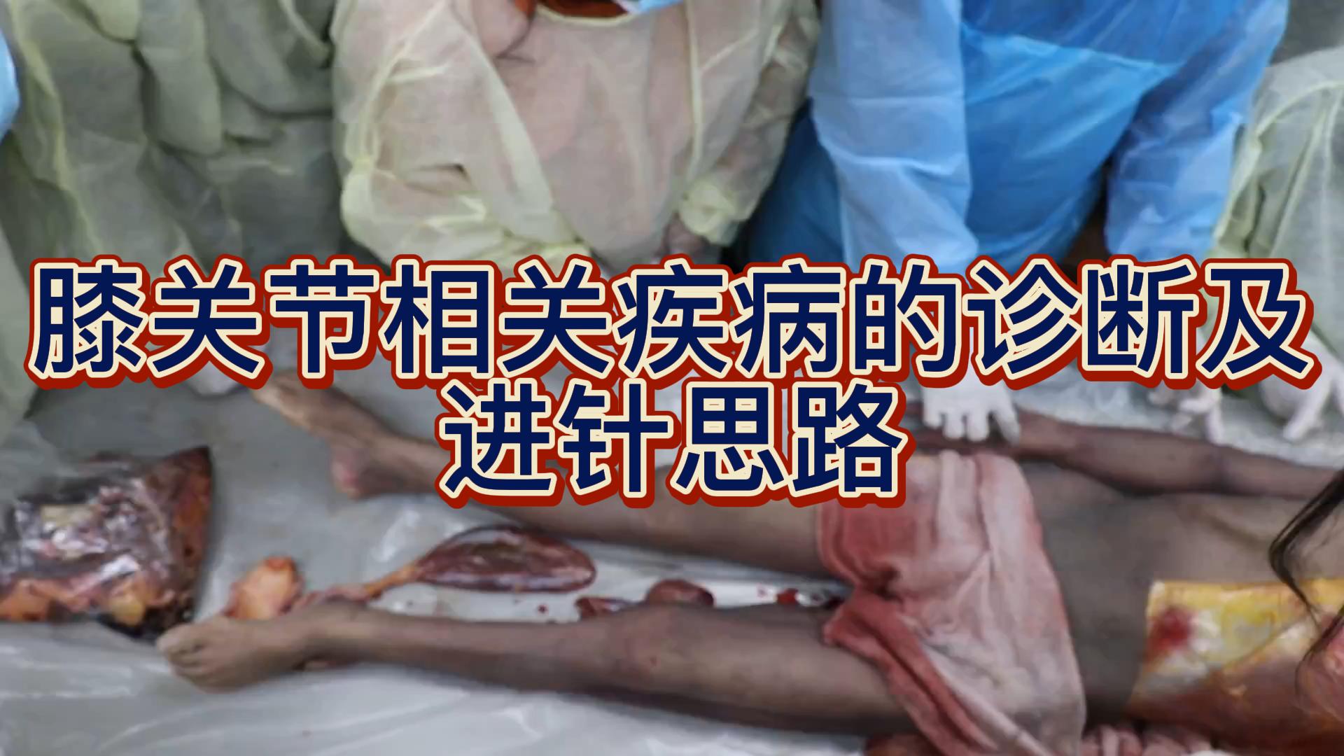 膝关节相关疾病的诊断及进针思路视频封面