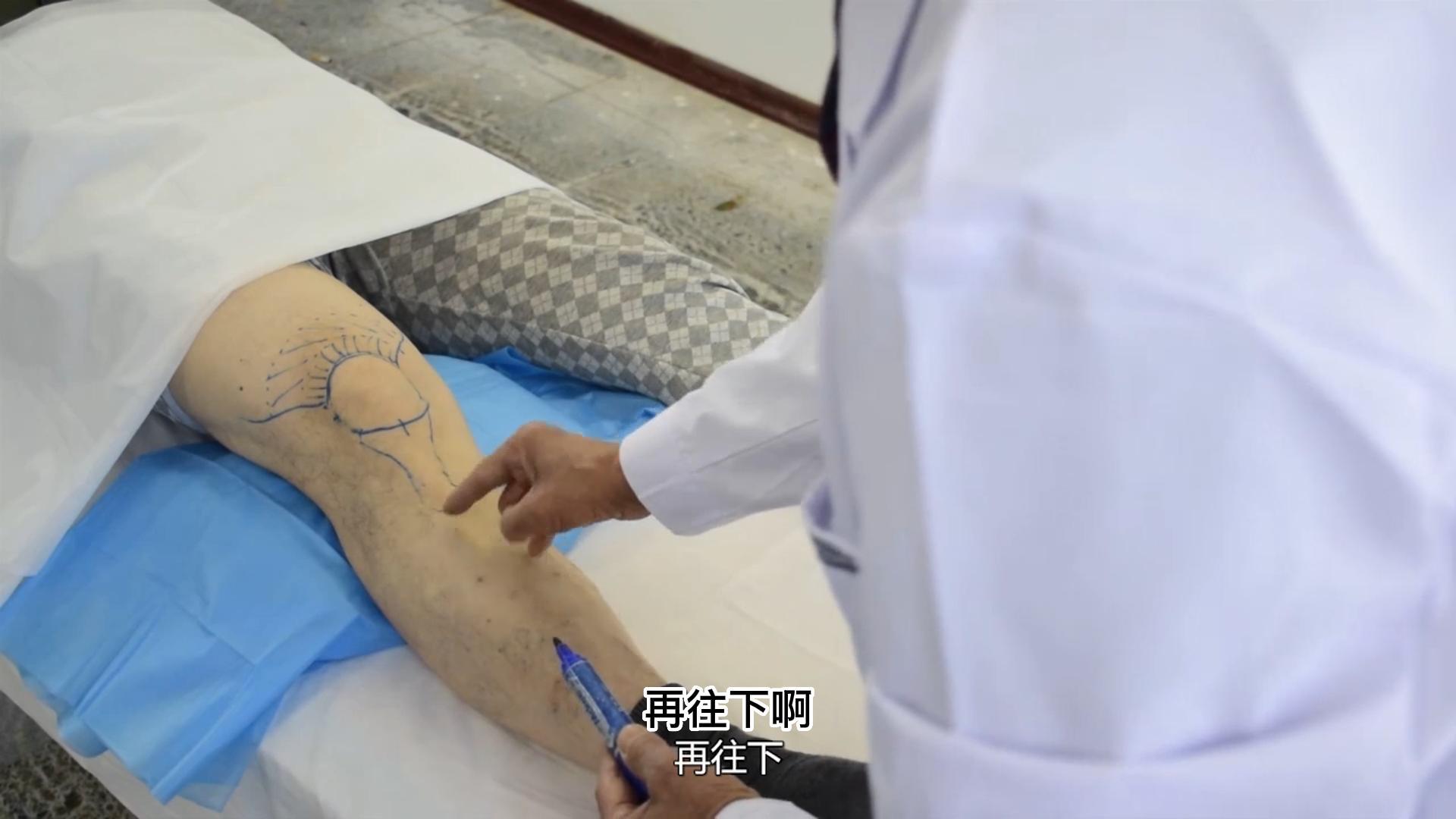 膝关节触诊检查及相关试验视频封面