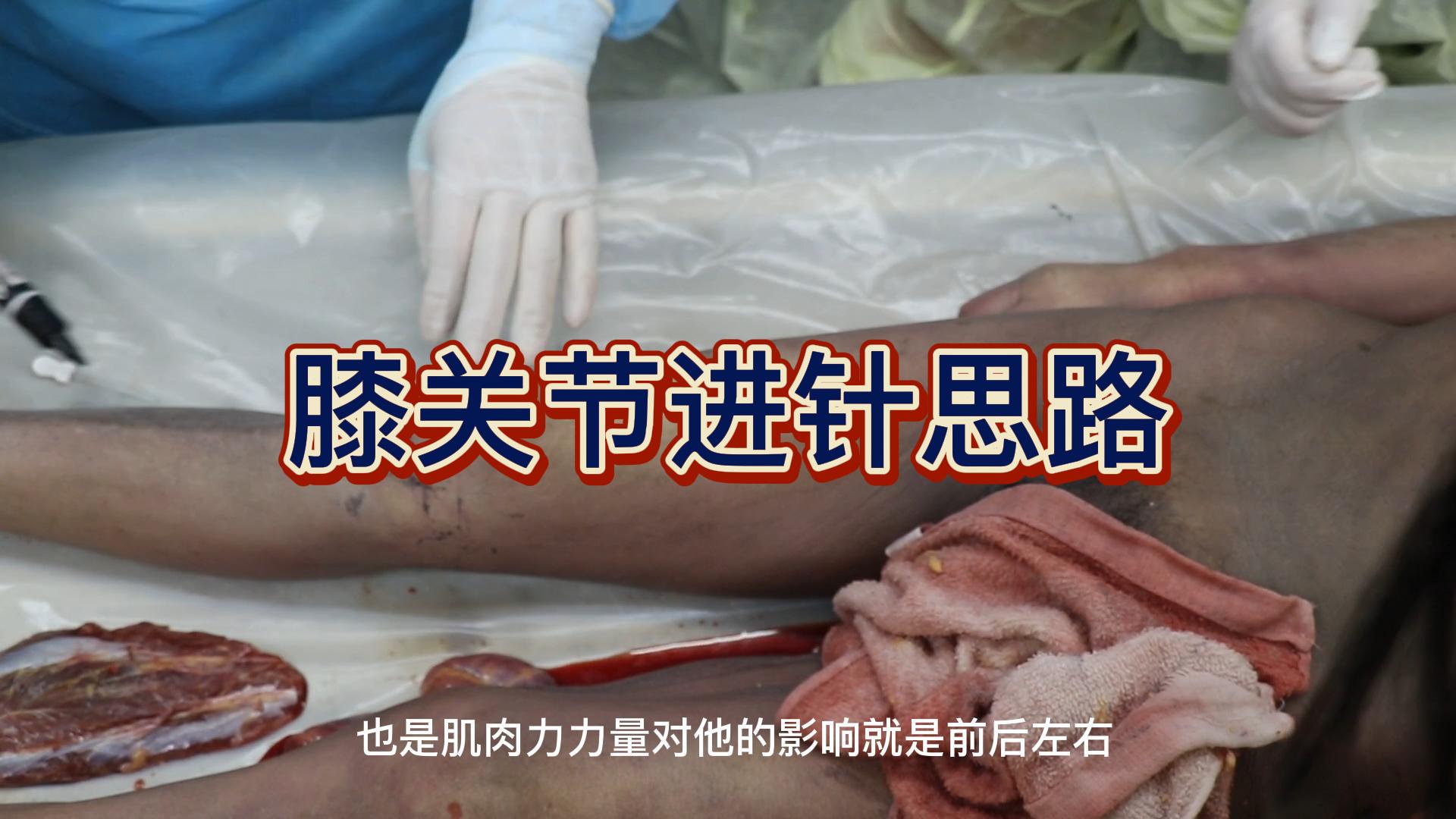膝关节进针思路视频封面