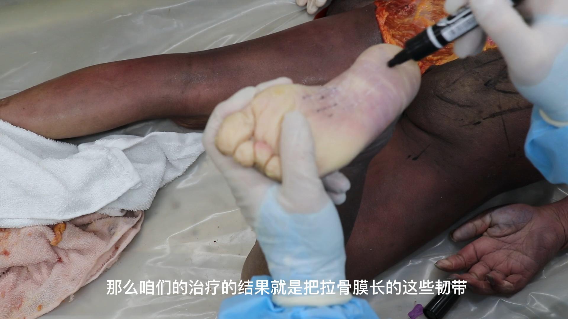 足部疾病及进针思路视频封面
