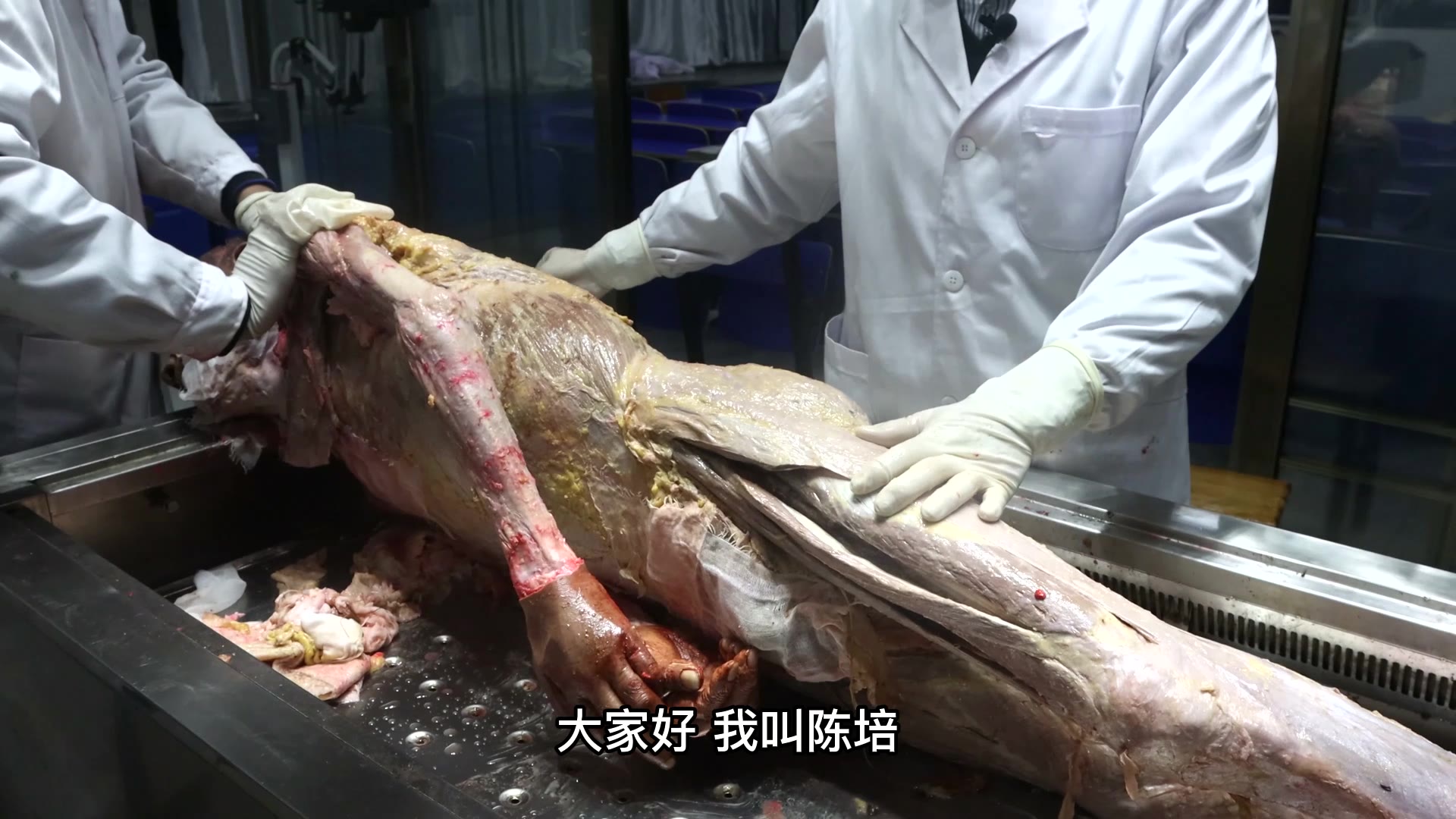 陈培临床解剖18阔筋膜张肌与髂胫束视频封面