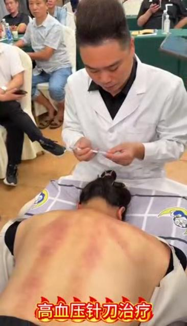 高血压针刀治疗视频视频封面